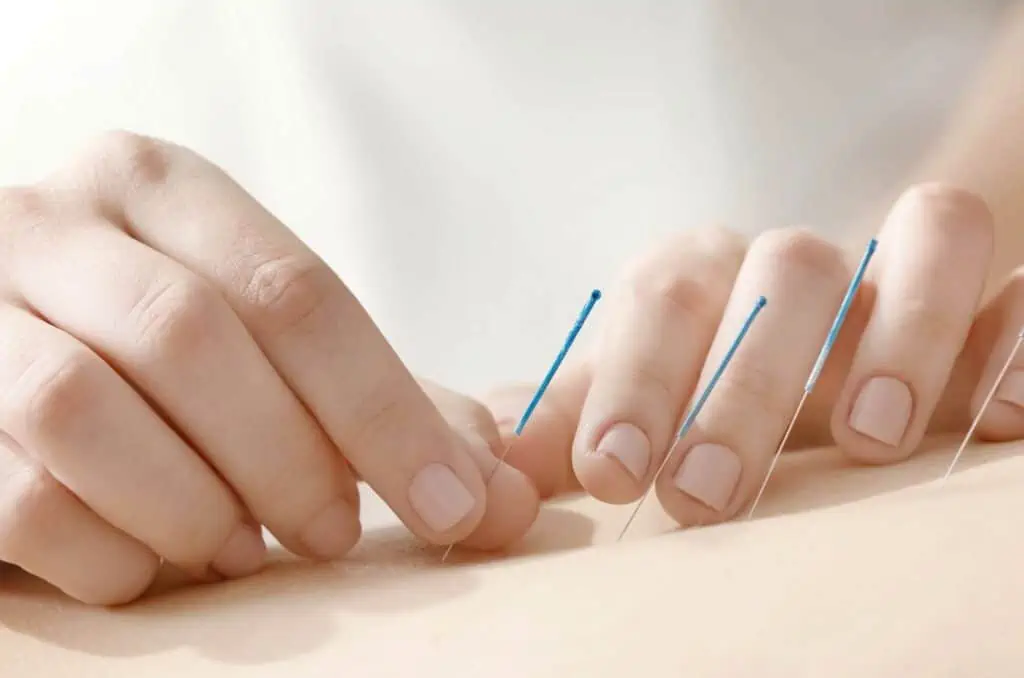 Dirk Arndt Orthopaedische Praxis Engen Akupunktur 97801458_m