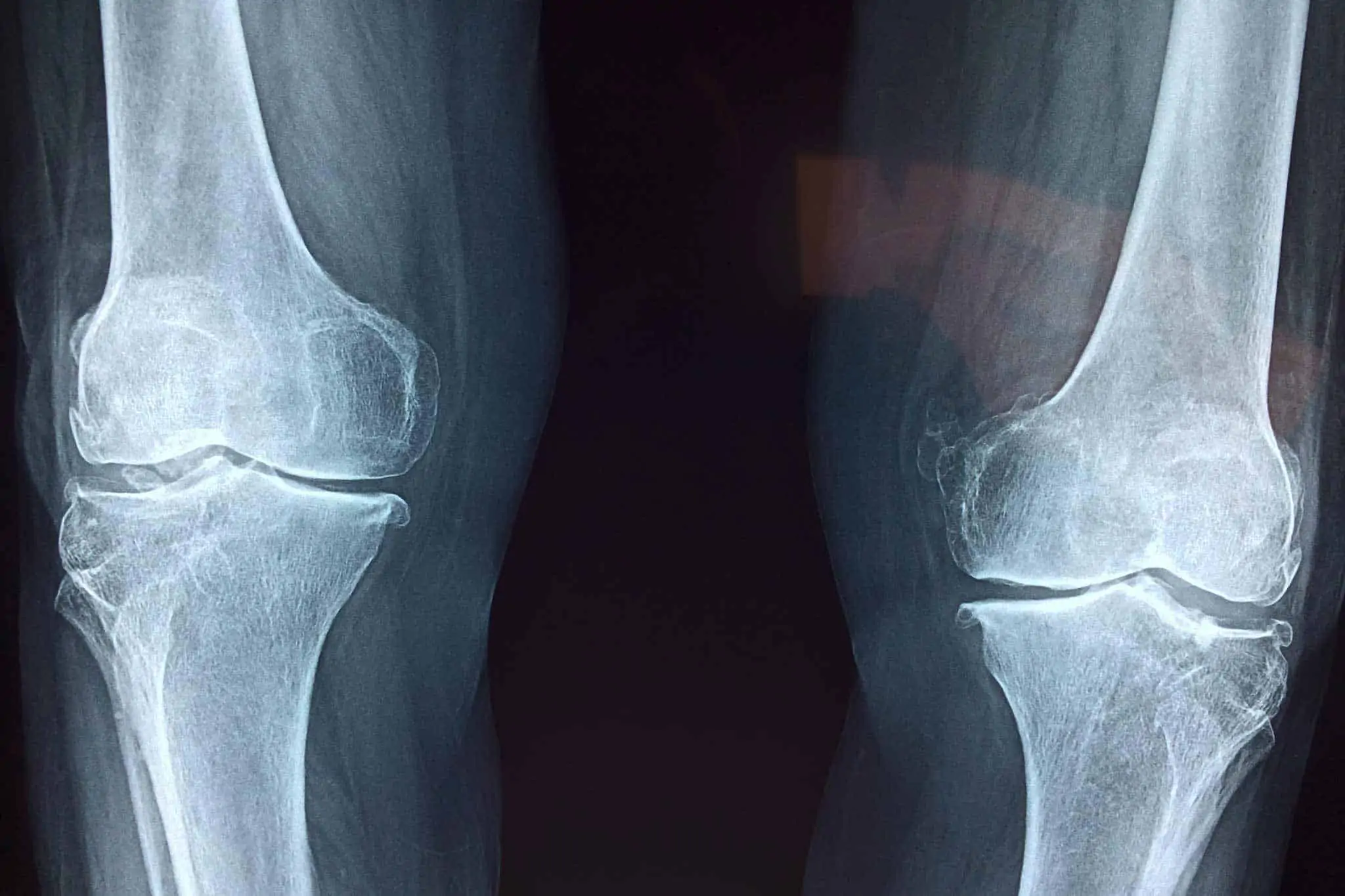 Dirk Arndt Orthopaedische Praxis Engen Knee 2253047